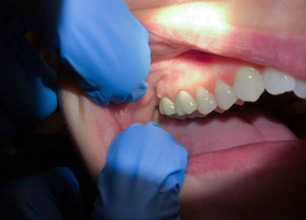 Best Holiday Emergency Dentist in Mount Holly, NC