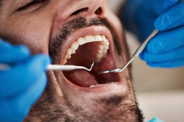 Best Emergency Cosmetic Dentistry in Mount Holly, NC