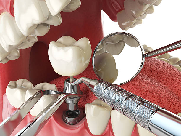 Best Emergency Dental Extractions in Mount Holly, NC